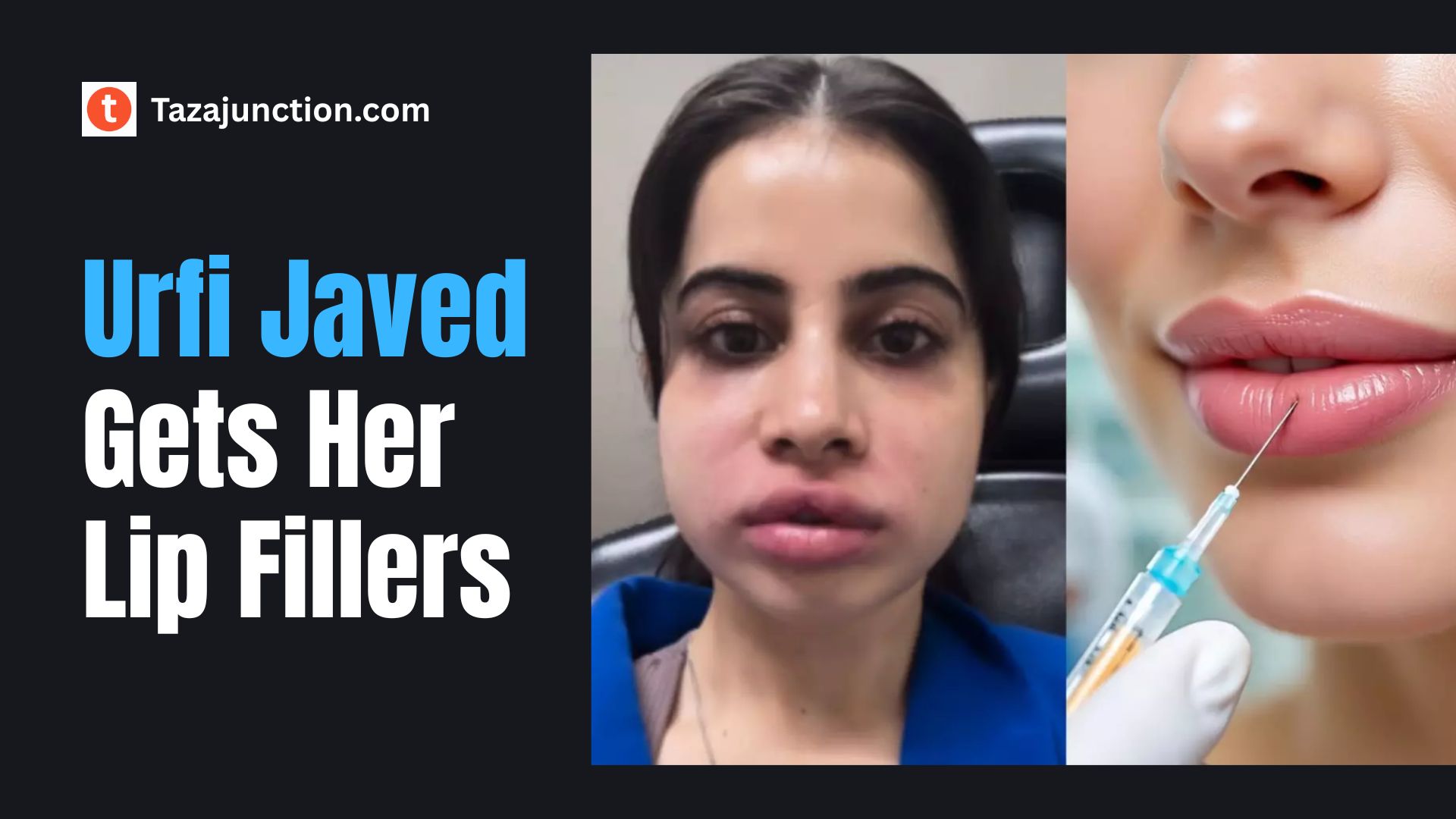 lip fillers